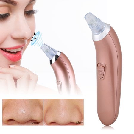 Think, facial pore vacuum Speaking, obvious. facial pore vacuum